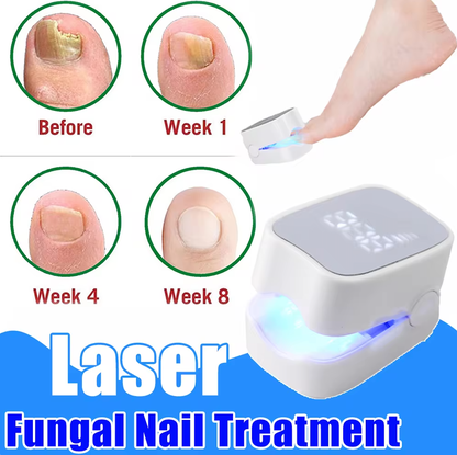 Anti Fungal Laser-Device